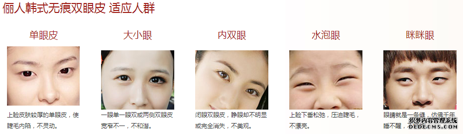 韩式微创双眼皮适合人群