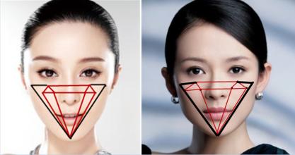 上海伊莱美整形医院李湘原下颌角磨骨案例 上海伊莱美整形医院李湘原下颌角磨骨案例