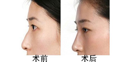 北京第二炮总医院伊光 北京第二炮总医院伊光