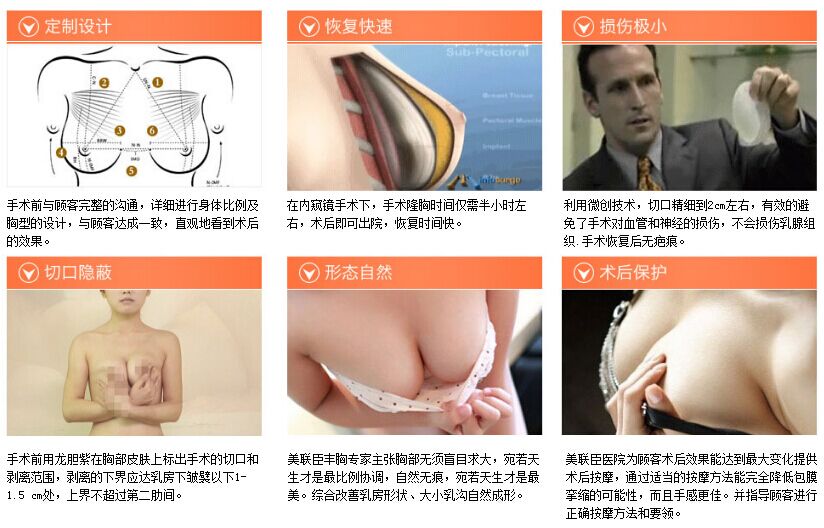 上海美联臣李耐国假体隆胸案例图 上海美联臣李耐国假体隆胸案例图