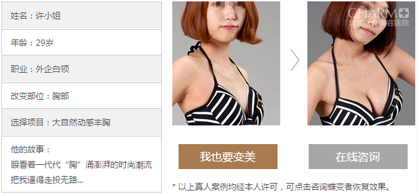 上海玫瑰张东旭内窥镜隆胸案例 上海玫瑰张东旭内窥镜隆胸案例