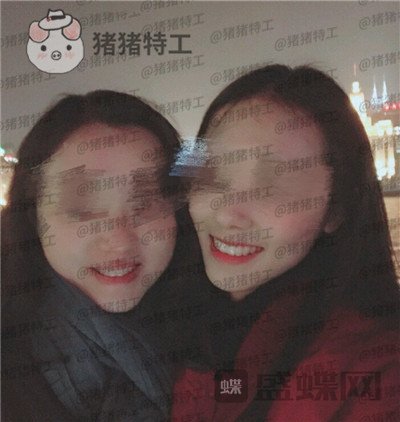 成都博爱,李竞男,牙齿美白,案例,价格,